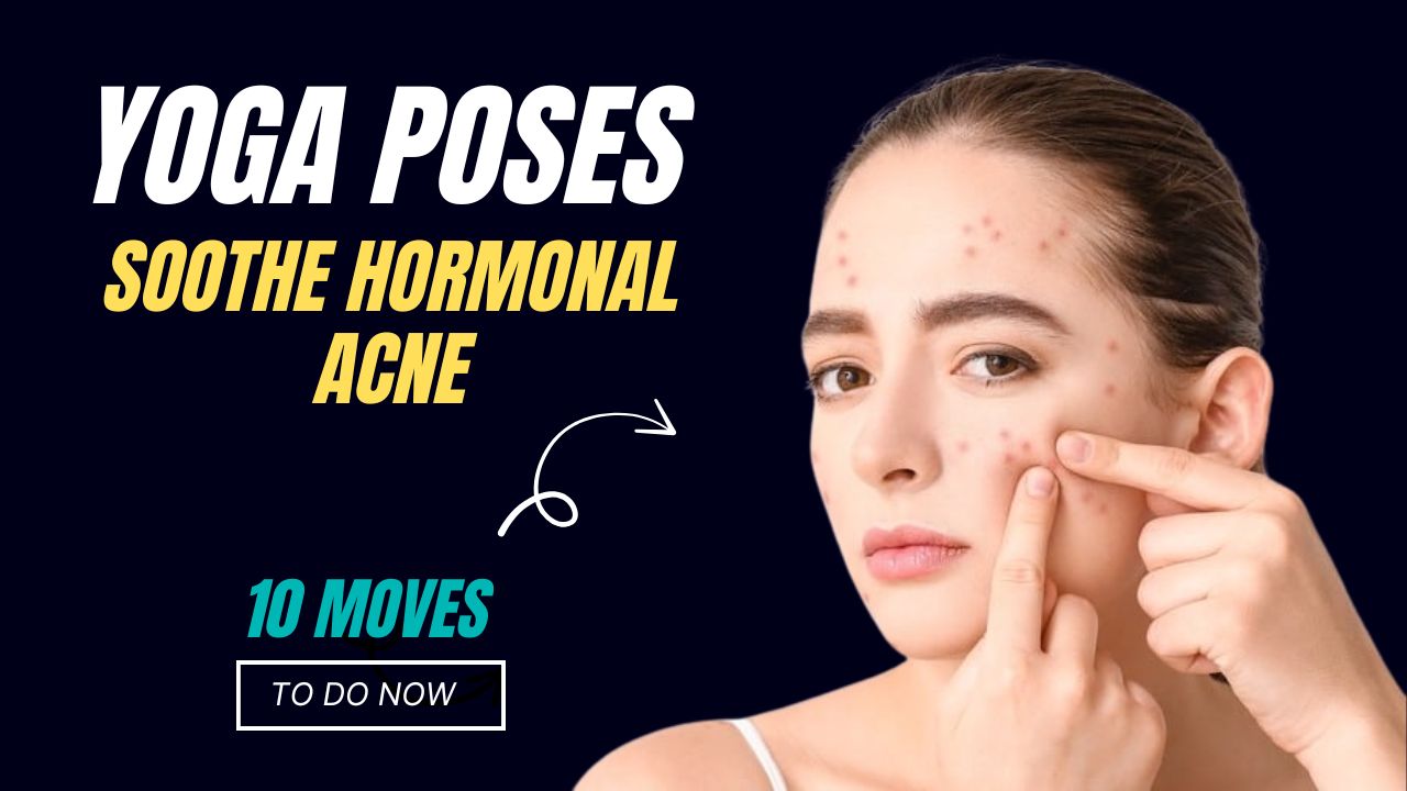 10 Powerful Yoga Poses That Soothe Hormonal Acne